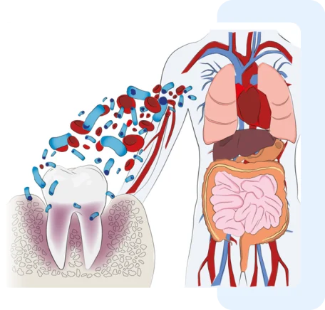 helbo-zahn-zu-koerper-info